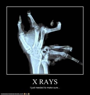 X RAYS