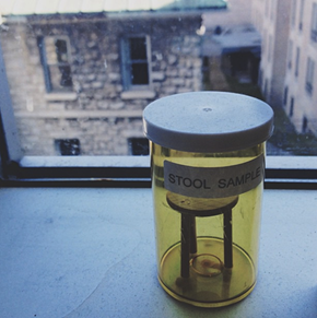 Stool Sample