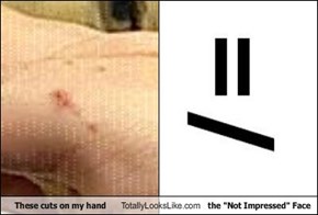 These cuts on my hand Totally Looks Like the "Not Impressed" Face